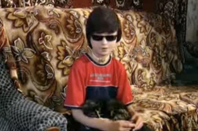 
        &laquo;Кровь и слезы&raquo;. Как живет парень, чье лицо 20 лет назад обглодал стафф    