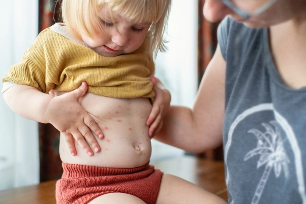 «Высыпало». Почему возвращается герпес и можно ли этого избежать?
«Высыпало». Почему возвращается герпес и можно ли этого избежать?