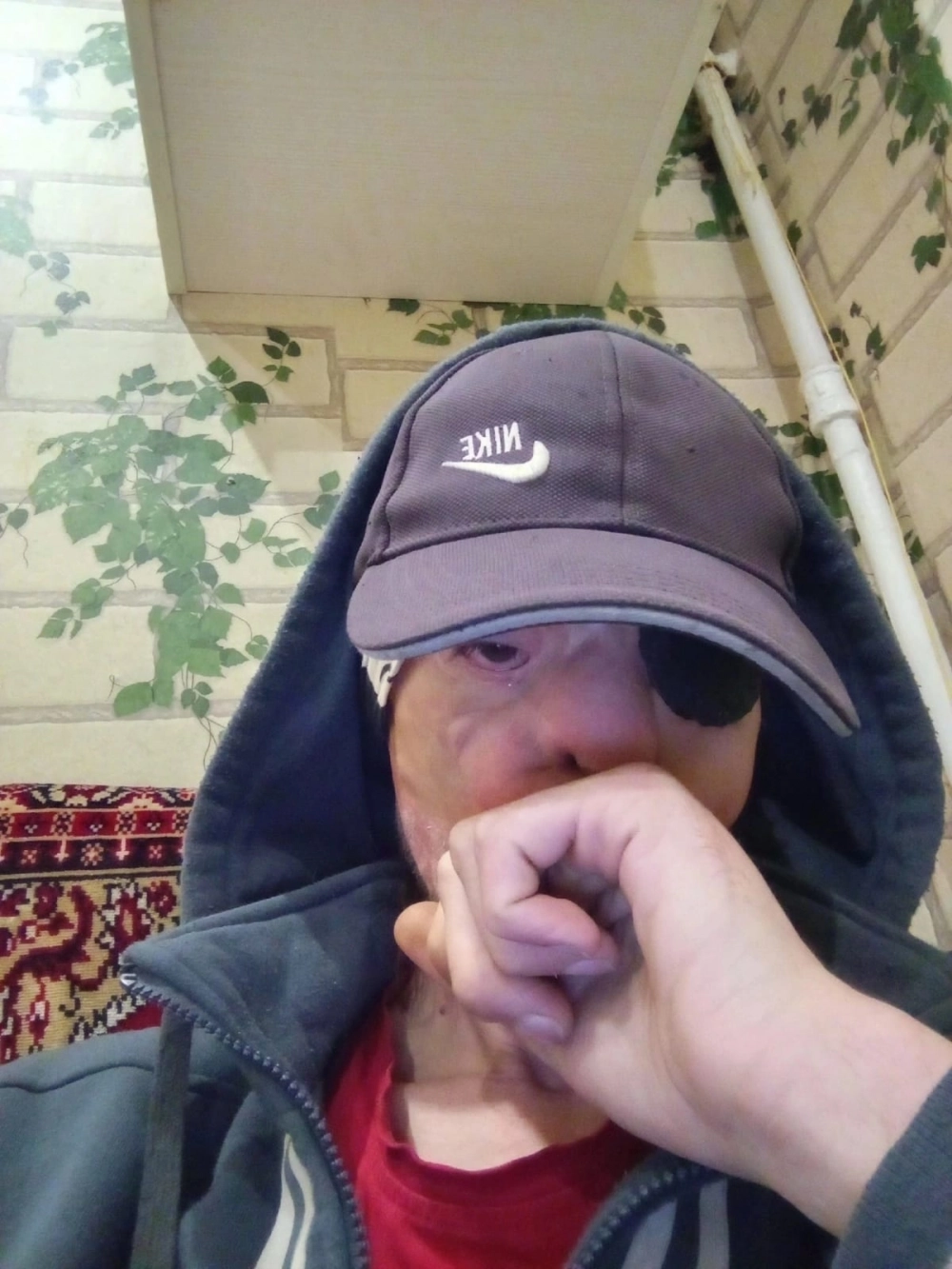 
        &laquo;Кровь и слезы&raquo;. Как живет парень, чье лицо 20 лет назад обглодал стафф    