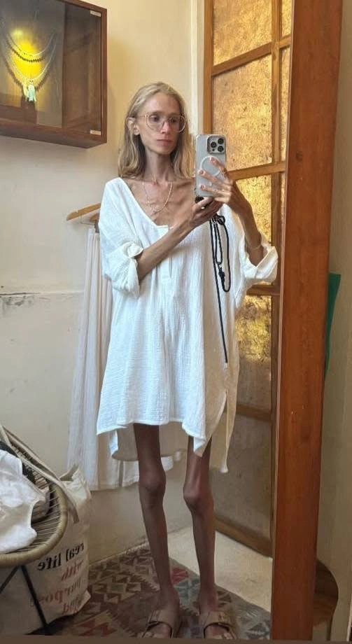 
        Боялась загрязнить душу. Девушка ела одни фрукты и умерла, похудев до 23 кг    