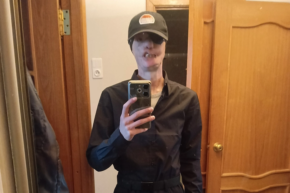 
        Любовь спасла. Игорь Виноградов, чье лицо обглодал стафф, женился    