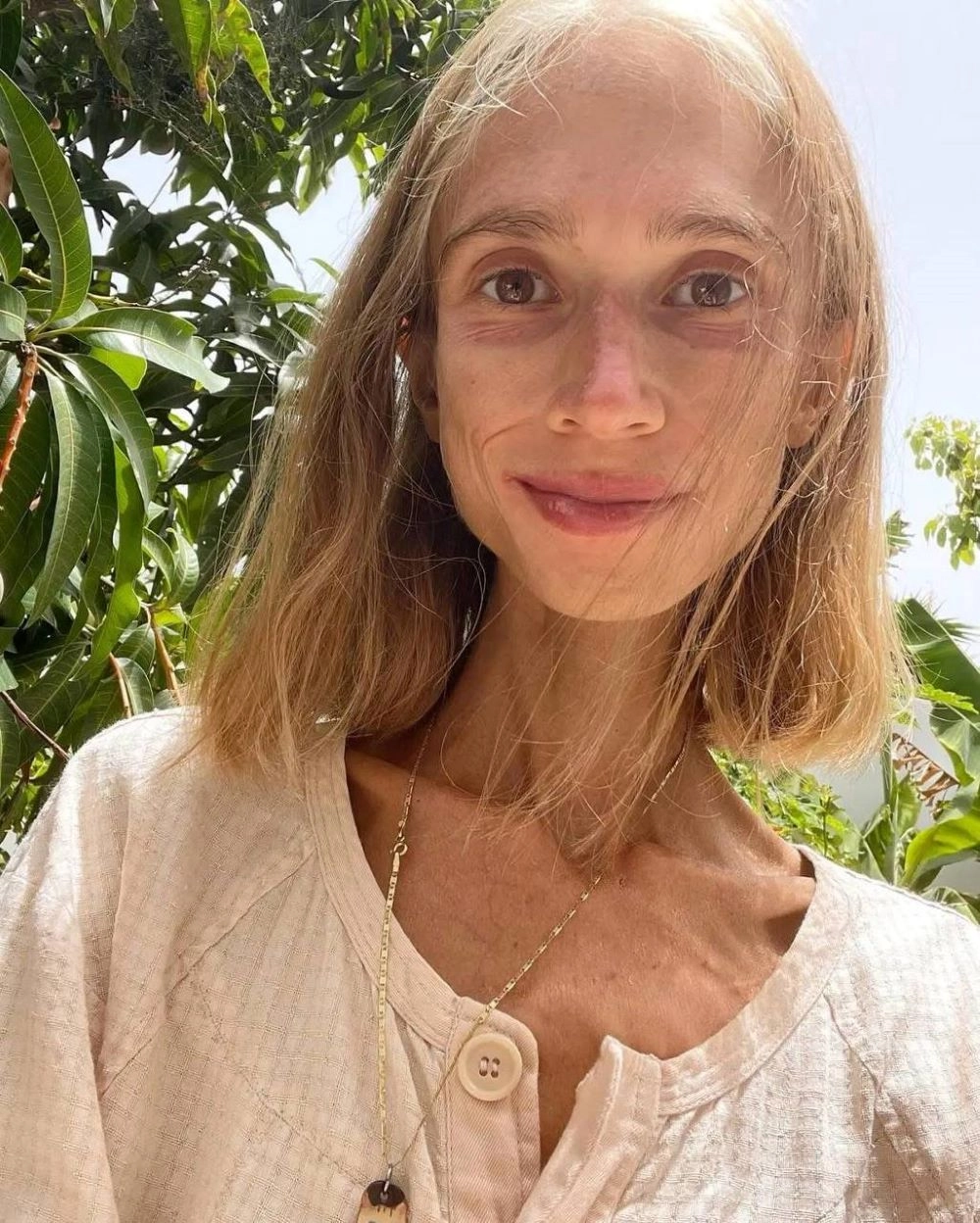 
        Боялась загрязнить душу. Девушка ела одни фрукты и умерла, похудев до 23 кг    