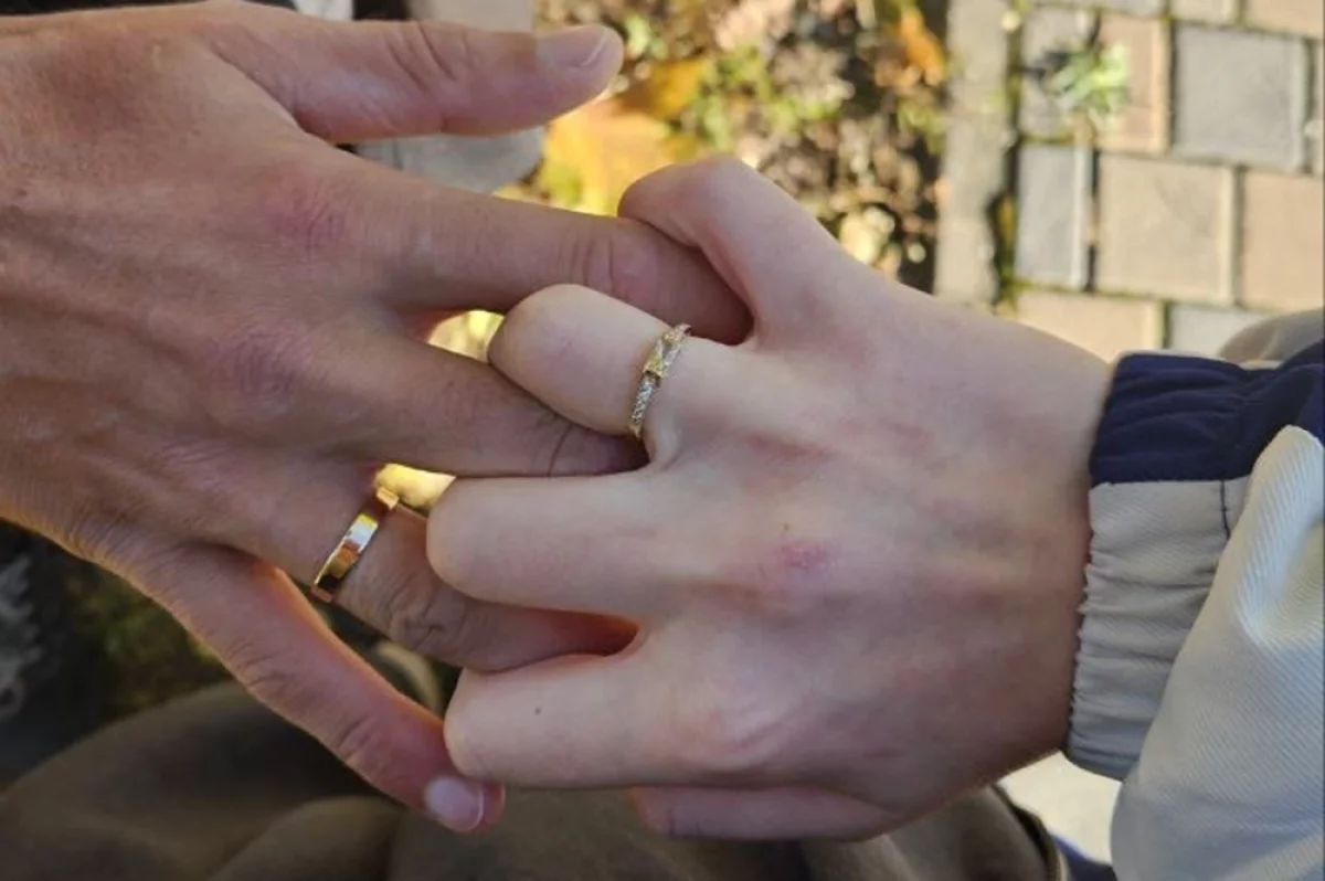 
        Любовь спасла. Игорь Виноградов, чье лицо обглодал стафф, женился    