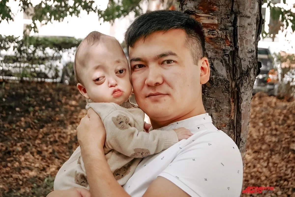 Пульсация мысли. Малышка Айпери нуждается в операции по реконструкции черепа
Пульсация мысли. Малышка Айпери нуждается в операции по реконструкции черепа