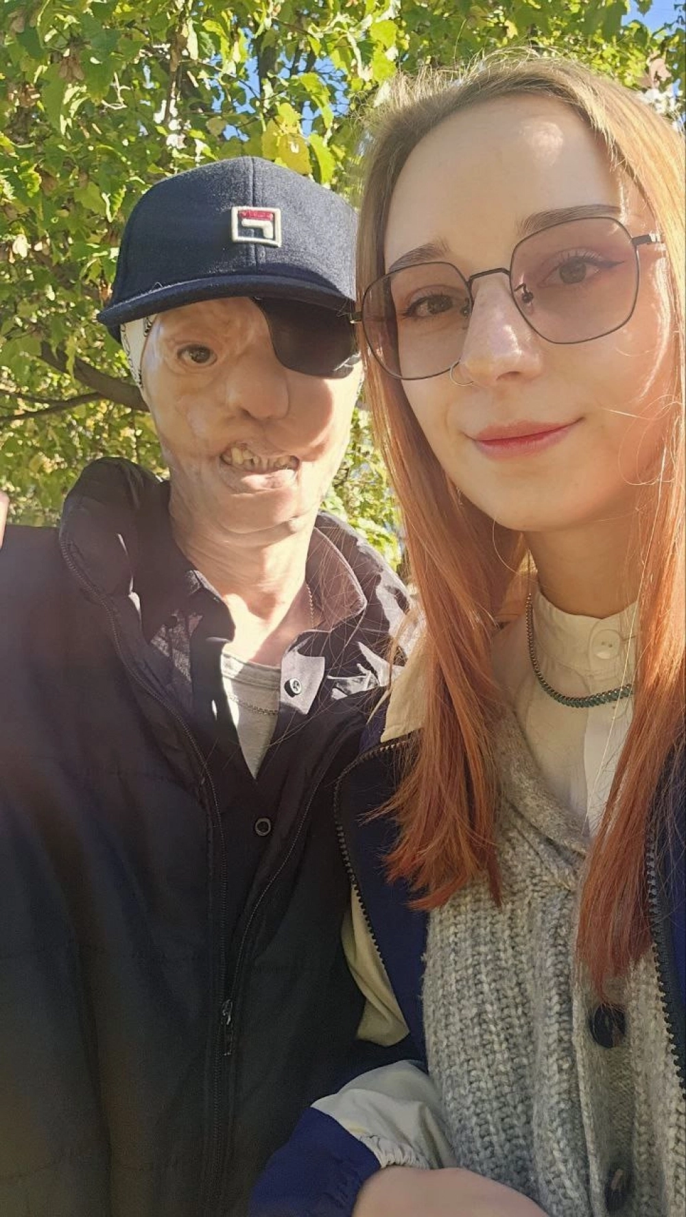 
        Любовь спасла. Игорь Виноградов, чье лицо обглодал стафф, женился    